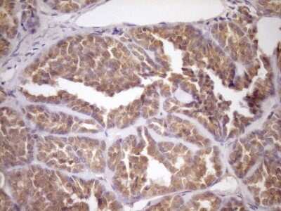 Immunohistochemistry: FSIP1 Antibody (OTI4F9) [NBP2-45738]