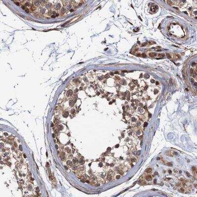 Immunohistochemistry-Paraffin: FSIP1 Antibody [NBP1-81959]