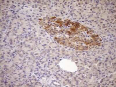 Immunohistochemistry: FSIP1 Antibody (OTI4F9) - Azide and BSA Free [NBP2-72451]
