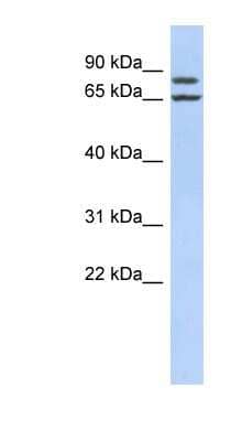 Western Blot: FSIP1 Antibody [NBP1-56460]