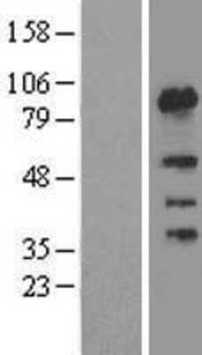 Western Blot: FSIP1 Overexpression Lysate [NBL1-10845]