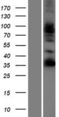 Western Blot: Follistatin-like 4/FSTL4 Overexpression Lysate [NBP2-07216]