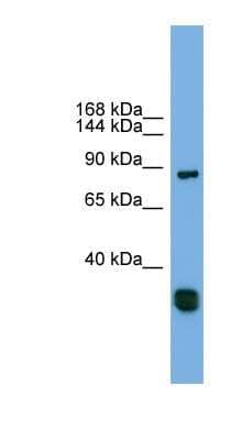 Western Blot: FSTL5 Antibody [NBP1-52853]