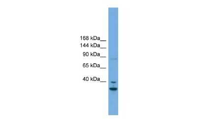 Western Blot: FSTL5 Antibody [NBP2-86638]