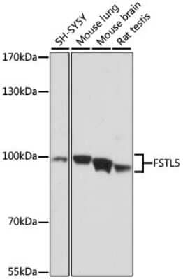 Western Blot: FSTL5 AntibodyAzide and BSA Free [NBP3-04852]