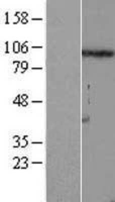 Western Blot: FSTL5 Overexpression Lysate [NBL1-10849]