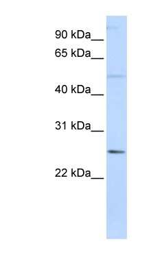 Western Blot: FTHL17 Antibody [NBP1-59998]