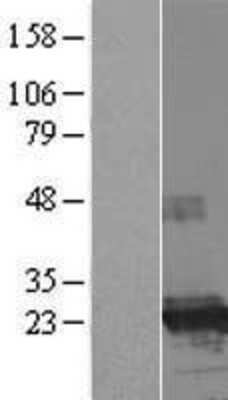 Western Blot: FTHL17 Overexpression Lysate [NBP2-06110]