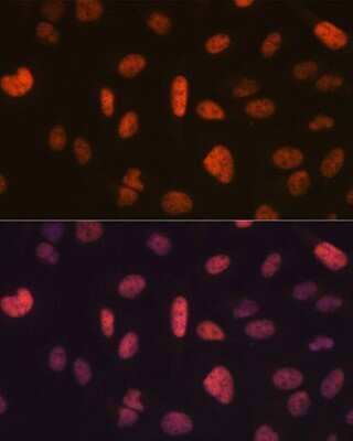 Immunocytochemistry/ Immunofluorescence: FTO Antibody (2Q9K10) [NBP3-16285]