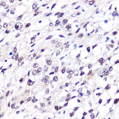 Immunohistochemistry-Paraffin: FTO Antibody (2Q9K10) [NBP3-16285]