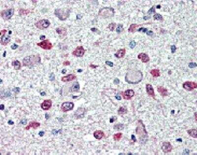 Immunohistochemistry-Paraffin: FTO Antibody (AG103) - Azide and BSA Free [NBP2-80051]