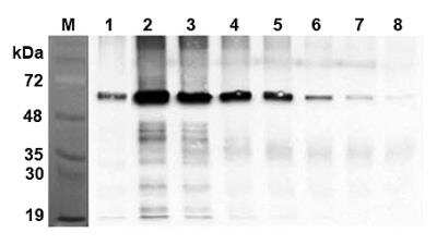 Immunoprecipitation: FTO Antibody (AG103) - Azide and BSA Free [NBP2-80051]