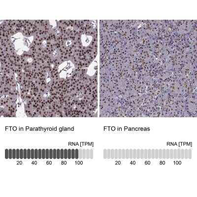 Immunohistochemistry-Paraffin: FTO Antibody [NBP2-62659]