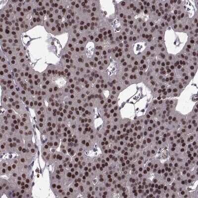 Immunohistochemistry-Paraffin: FTO Antibody [NBP2-62659]