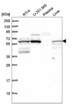 Western Blot: FTO Antibody [NBP2-58941]