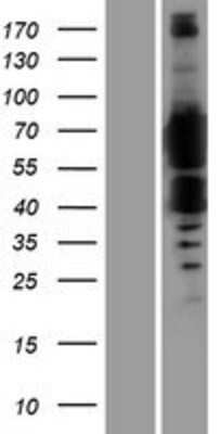 Western Blot: FTO Overexpression Lysate [NBP2-08494]