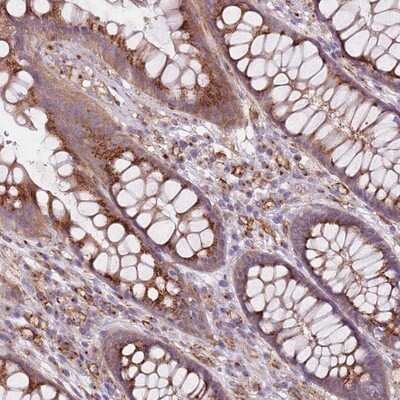 Immunohistochemistry-Paraffin: FTS Antibody [NBP2-14279]