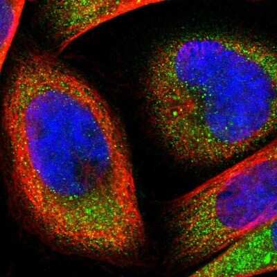 Immunocytochemistry/ Immunofluorescence: FTSJ1 Antibody [NBP1-85703]