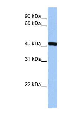 Western Blot: FTSJ1 Antibody [NBP1-52940]