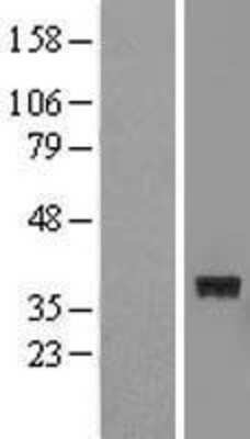 Western Blot: FTSJ1 Overexpression Lysate [NBL1-10853]