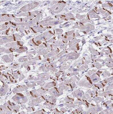 Immunohistochemistry: FTSJ2 Antibody [NBP2-30601]