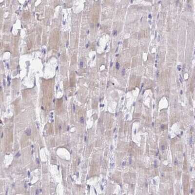 Immunohistochemistry-Paraffin: FTSJ2 Antibody [NBP2-30894]