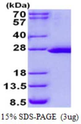 SDS-PAGE: Recombinant Human FTSJ2 His Protein [NBP2-23062]