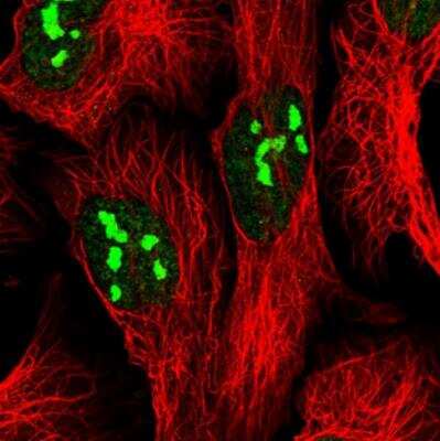 Immunocytochemistry/ Immunofluorescence: FTSJ3 Antibody [NBP2-30672]