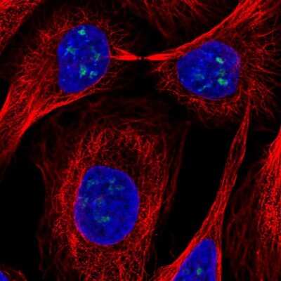 Immunocytochemistry/ Immunofluorescence: FTSJ3 Antibody [NBP2-57530]