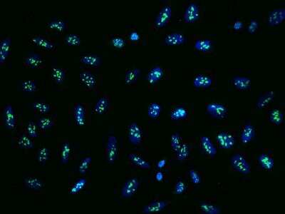 Immunocytochemistry/ Immunofluorescence: FTSJ3 Antibody [NBP3-05948]