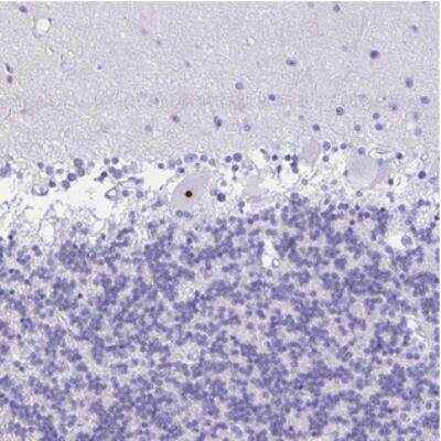 Immunohistochemistry-Paraffin: FTSJ3 Antibody [NBP2-30672]