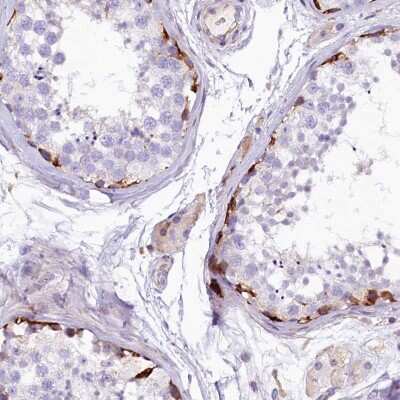 Immunohistochemistry-Paraffin: FTSJD1 Antibody [NBP2-30516]