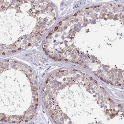 Immunohistochemistry-Paraffin: FTSJD1 Antibody [NBP2-30944]