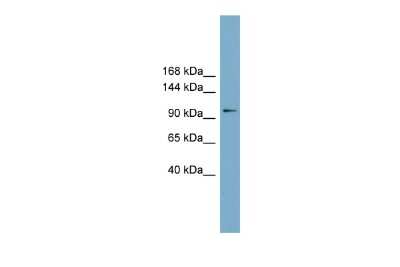 Western Blot: FTSJD1 Antibody [NBP2-87472]