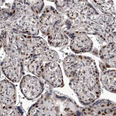 Immunohistochemistry-Paraffin: FTSJD2 Antibody [NBP1-83046]