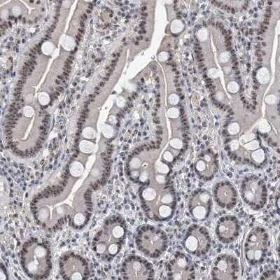 Immunohistochemistry-Paraffin: FTSJD2 Antibody [NBP1-83047]