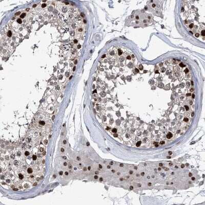 Immunohistochemistry-Paraffin: FTSJD2 Antibody [NBP1-83047]