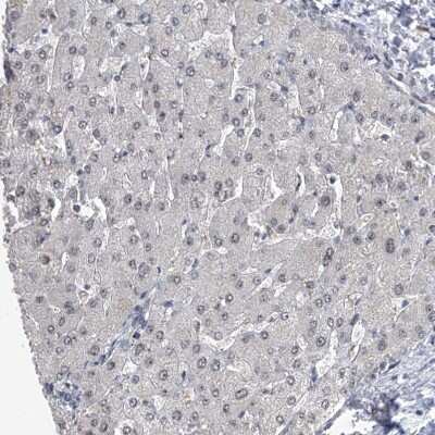 Immunohistochemistry-Paraffin: FTSJD2 Antibody [NBP1-83047]