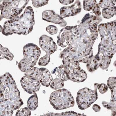Immunohistochemistry-Paraffin: FTSJD2 Antibody [NBP1-83047]