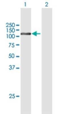 Western Blot: FTSJD2 Antibody [H00023070-B01P]