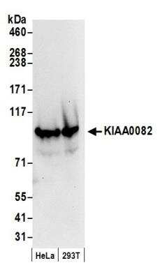 Western Blot: FTSJD2 Antibody [NB100-79786]