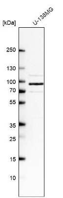 Western Blot: FTSJD2 Antibody [NBP1-83047]
