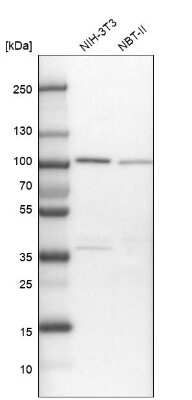 Western Blot: FTSJD2 Antibody [NBP1-83047]
