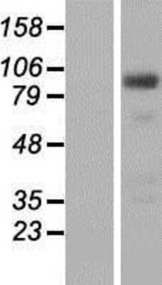 Western Blot: FTSJD2 Overexpression Lysate [NBP2-07229]