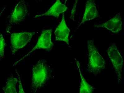 Immunocytochemistry/ Immunofluorescence: FUBI/MNSF beta/FAU Antibody (3C10) [H00002197-M03]