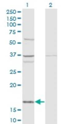 Western Blot: FUBI/MNSF beta/FAU Antibody (3C10) [H00002197-M03]