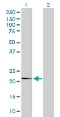 Western Blot: FUBI/MNSF beta/FAU Antibody [H00002197-D01P]