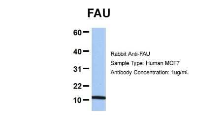 Western Blot: FUBI/MNSF beta/FAU Antibody [NBP1-55090]