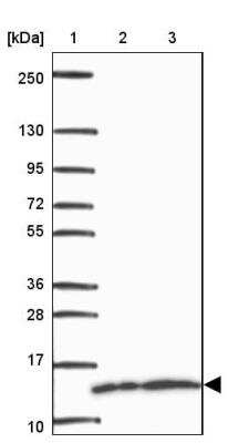 Western Blot: FUBI/MNSF beta/FAU Antibody [NBP2-32413]