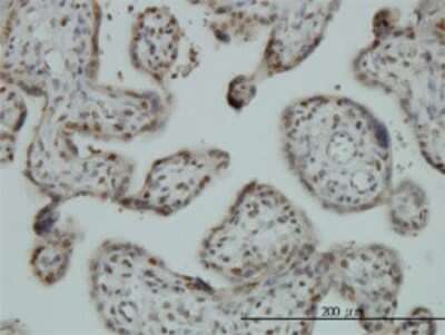 Immunohistochemistry-Paraffin: FUBP1 Antibody (3H4) [H00008880-M01]